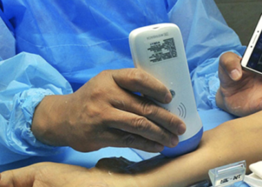 uzi_datchik_besprobodnoy