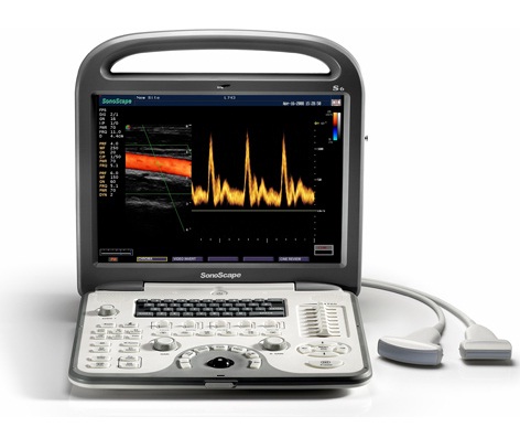 Портативний УЗД апарат 