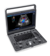 portativniy_uzi_apparat_c_cvetnim_doplerom