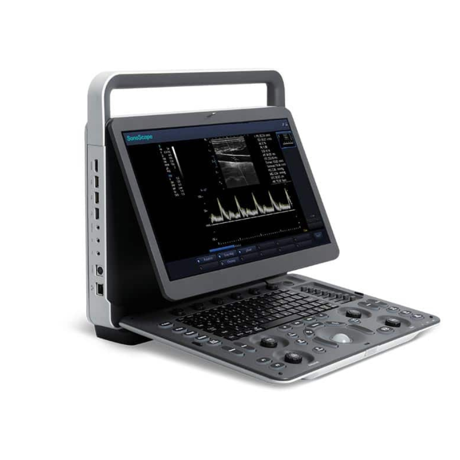 portativniy_uzd_aparat_kupiti