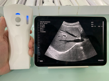 kupit_portativniy_uzd_datchik