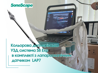 uzd_z_laparoskopichnim_datchikom