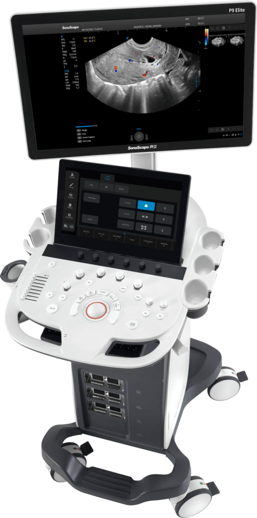 uzd_aparat_sonoscape_p9