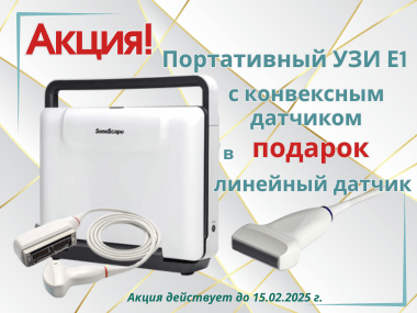 portativniy_uzi_kupit