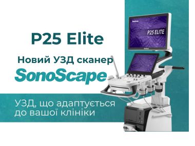 uzd_aparat_p25_elite_sonoscape