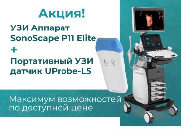 uzi_apparat_sonoscape