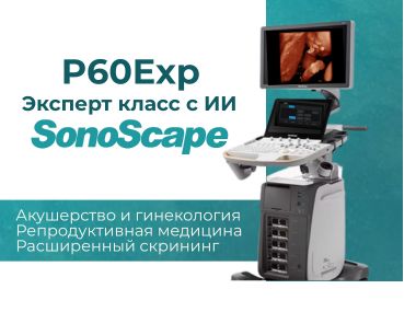 uzi_apparat_ekcpert_klassa