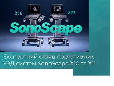 uzd-sonoscape_x10